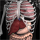 iPhone/iPadアプリ「Anatomy 3D - Organs」のアイコン